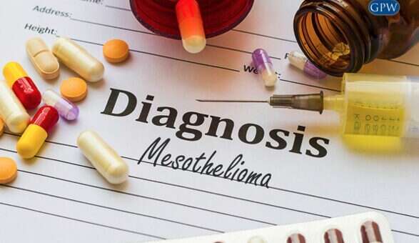 Common Questions About Mesothelioma