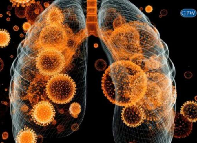 Pulmonary Fibrosis vs. Asbestosis: Understanding the Differences and Your Legal Rights