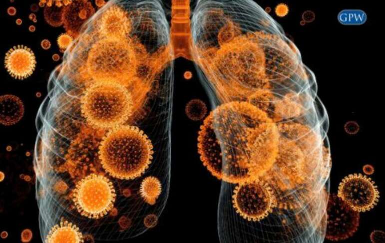 Pulmonary Fibrosis vs. Asbestosis: Understanding the Differences and Your Legal Rights